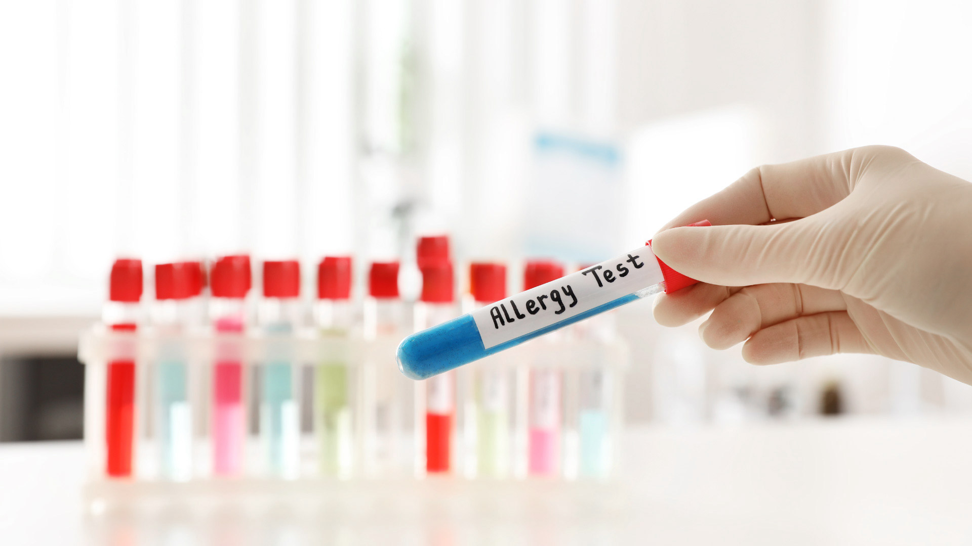 allergie-test